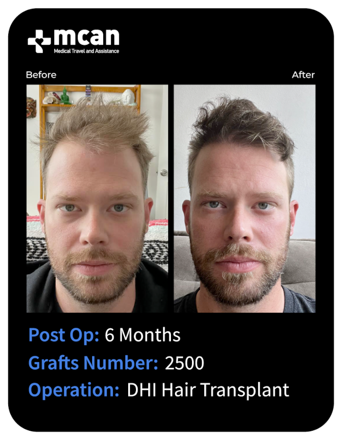 before after 1