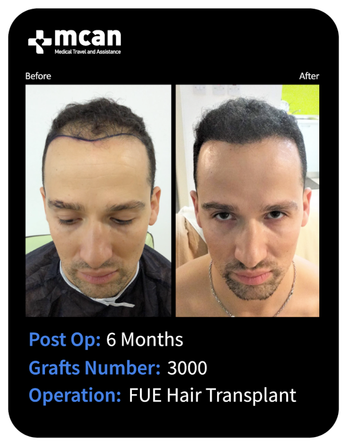 before after 13