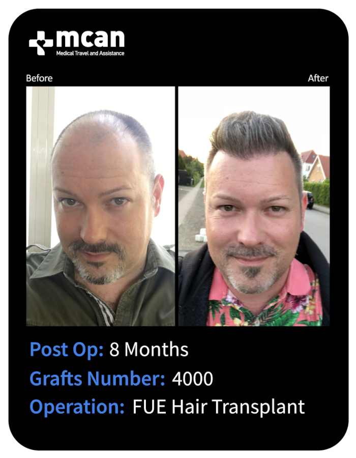 before after 14