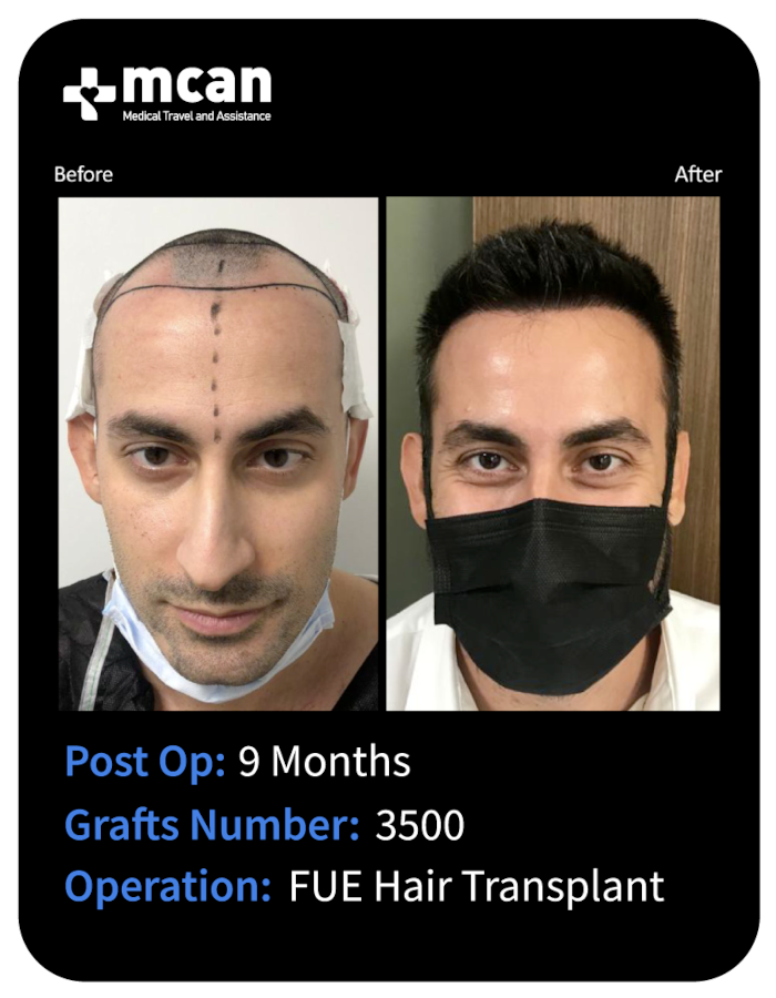 before after 19
