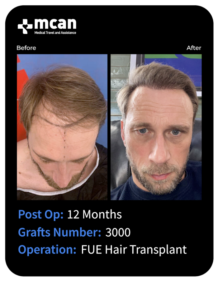 before after 2
