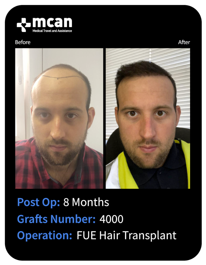 before after 21