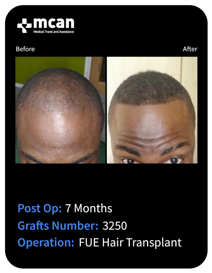 before after 24