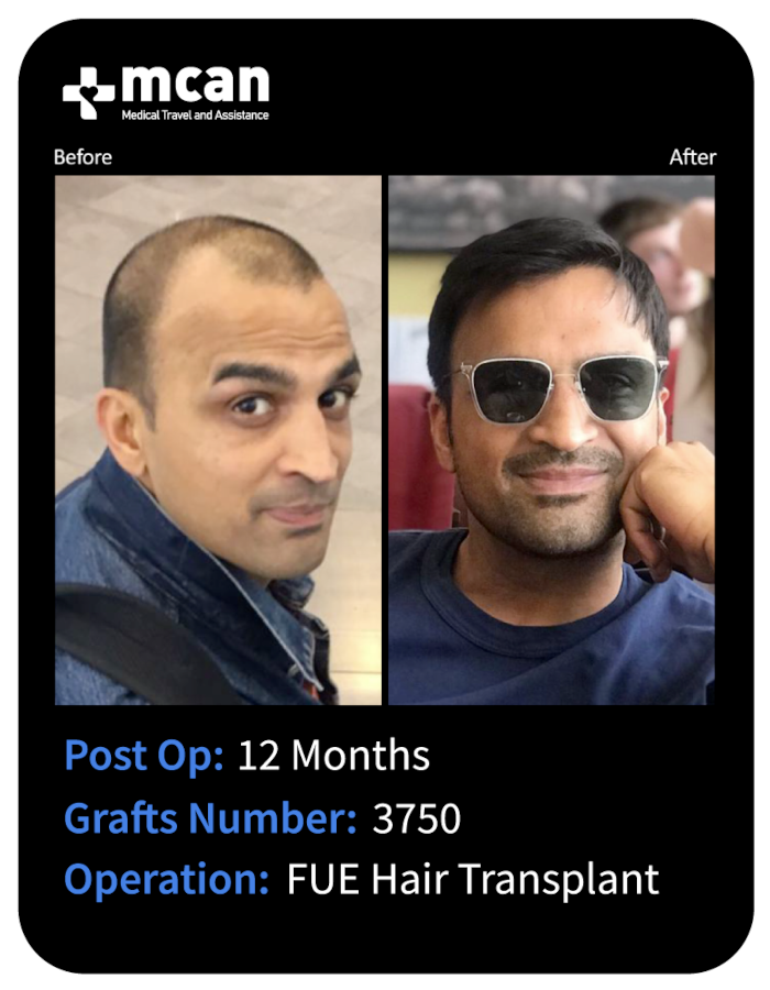before after 25