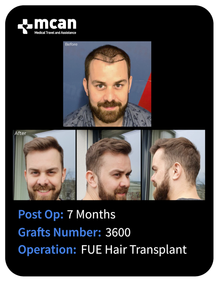 before after 26