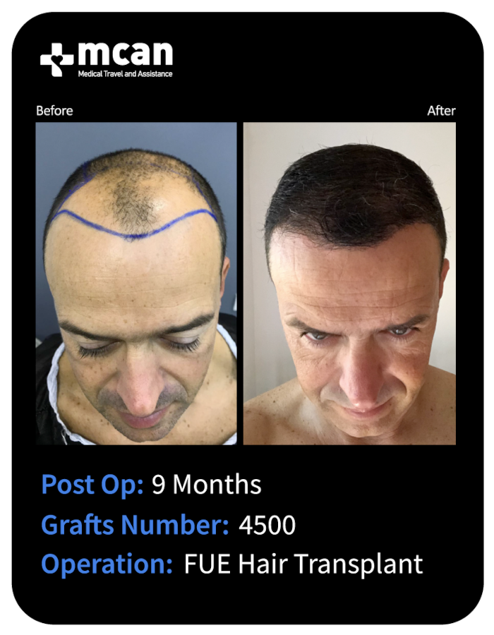 before after 27