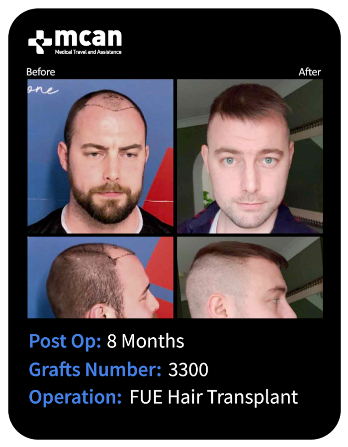 before after 29