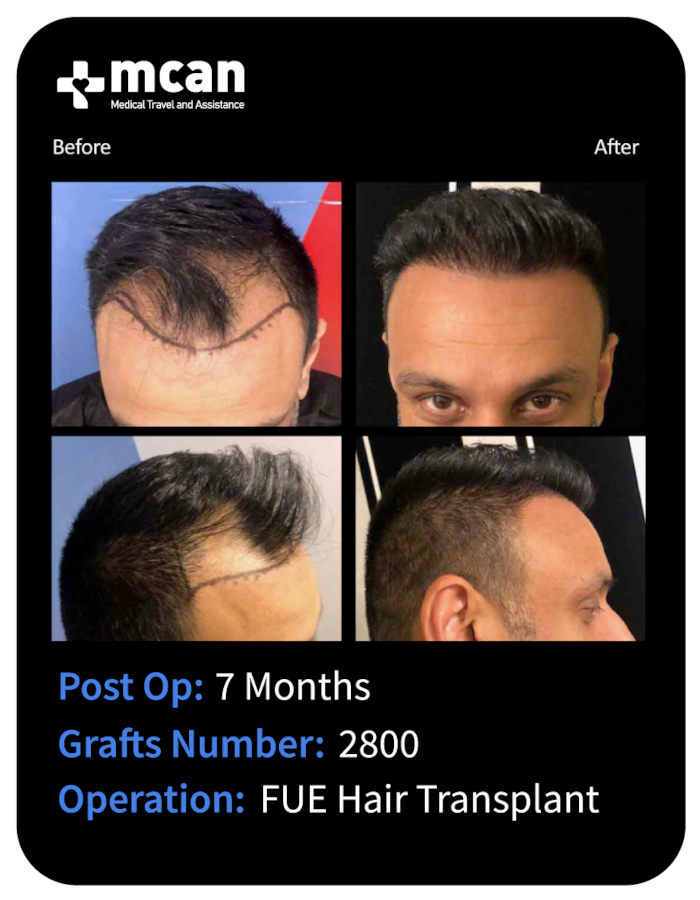before after 30