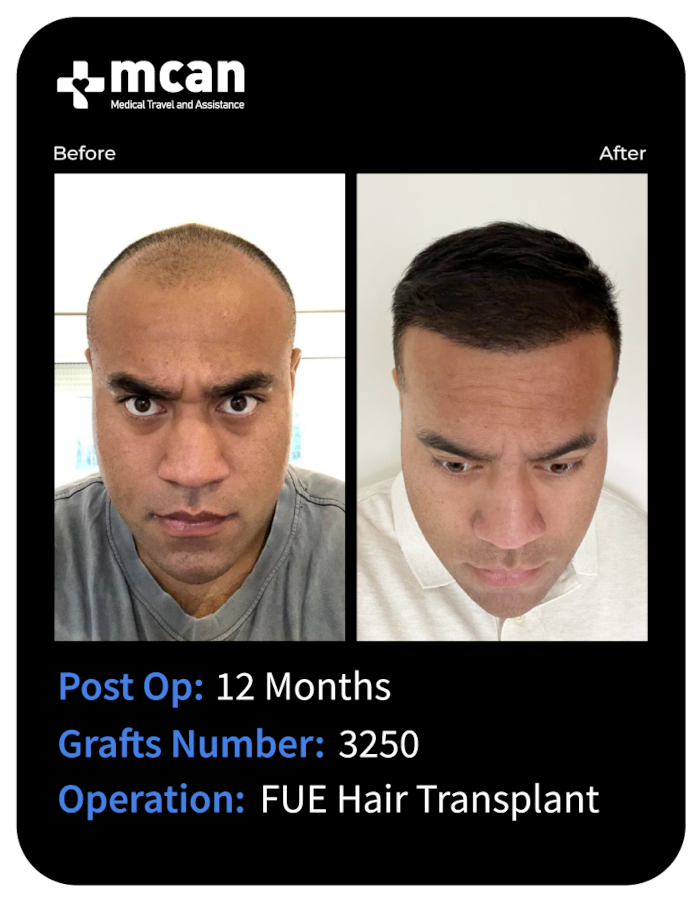 before after 5