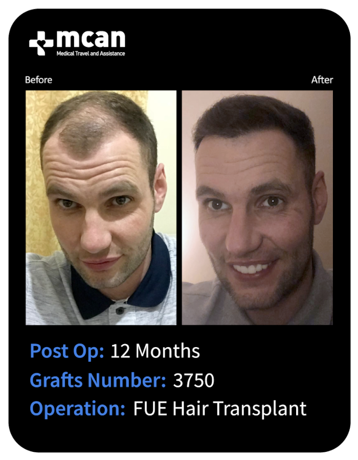 before after 6
