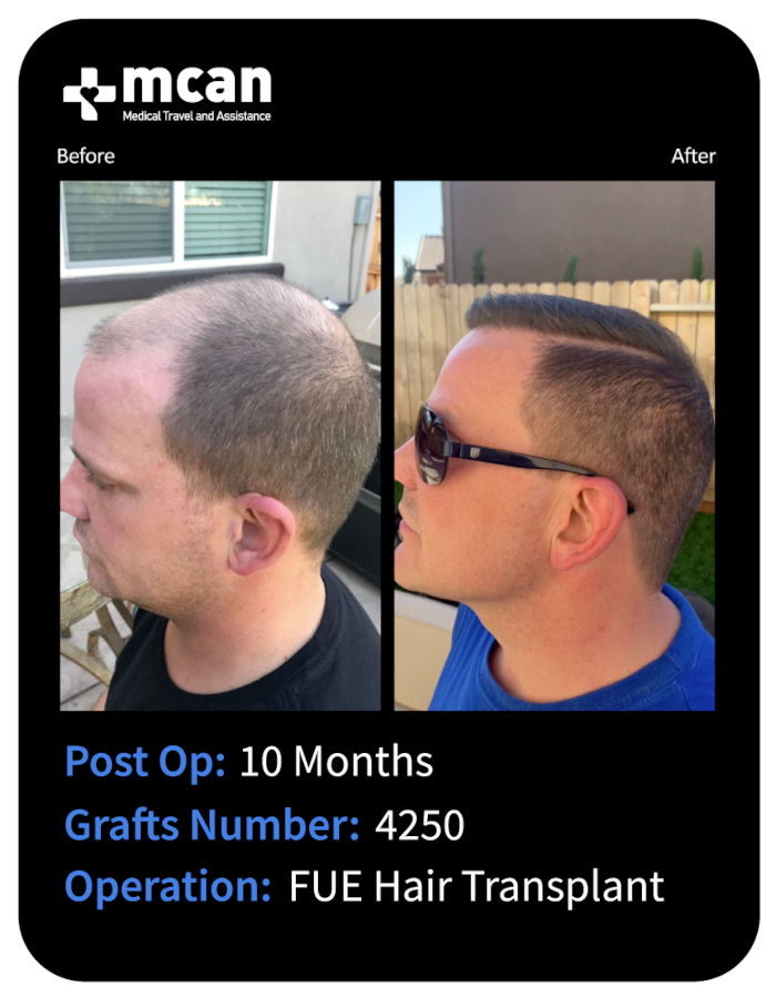 before after 7