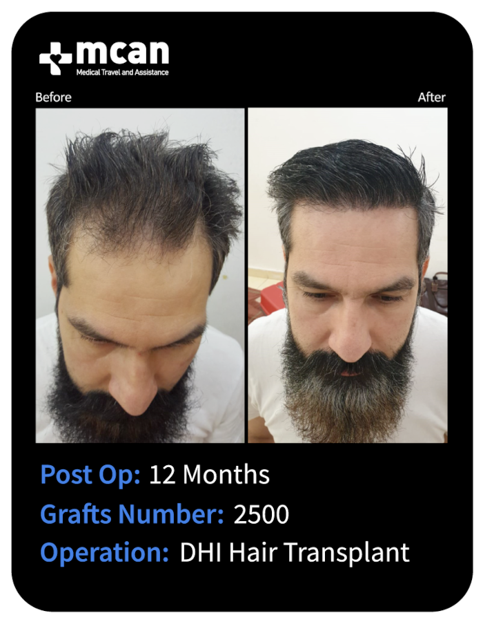 before after 8