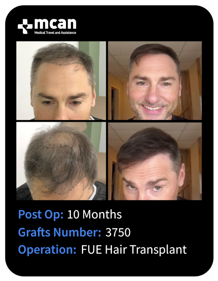 before after 9