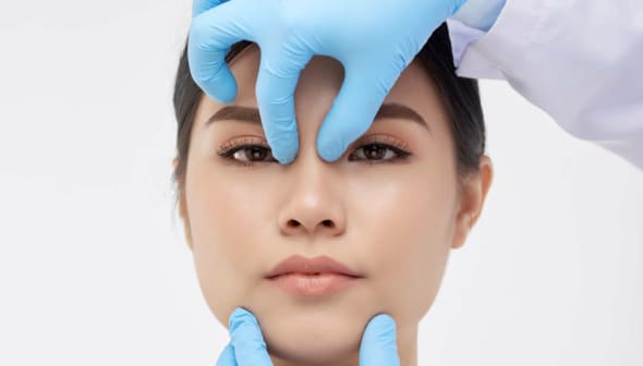 Rhinoplasty